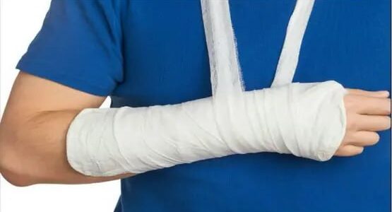 بحث يوضح: الأنسجة العضلية تحتوي على «خلايا بديلة» لعلاج شروخ العظام.