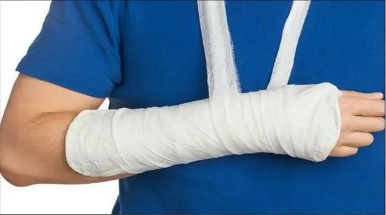 بحث يوضح: الأنسجة العضلية تحتوي على «خلايا بديلة» لعلاج شروخ العظام.