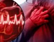 داء نقص التروية.. ما الذي تعرفه عن مسبباته وعلاماته وطرق معالجته وأساليب الوقاية؟