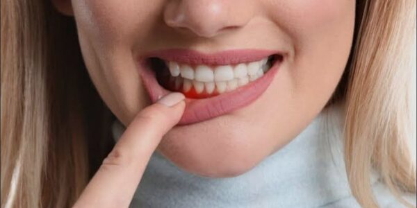 الأساس الداعم للأسنان.. ما مدى معرفتك بأمراض اللثة ووسائل علاجها وسبل الحماية منها؟