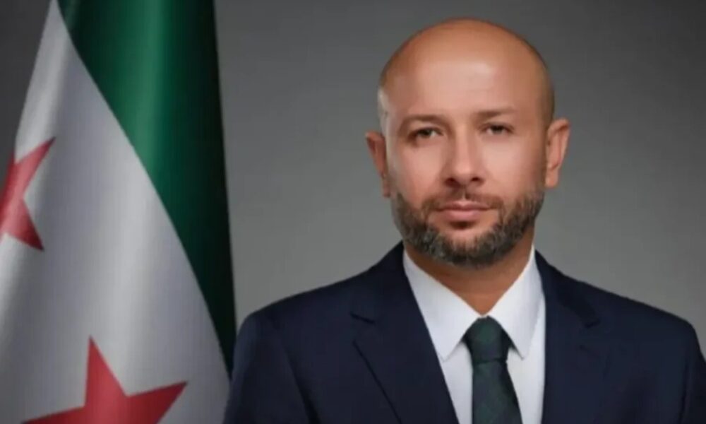 وزير الوضع الطارئ يشدد على متابعة الوزارة لمستجدات حادث انفجار العيس